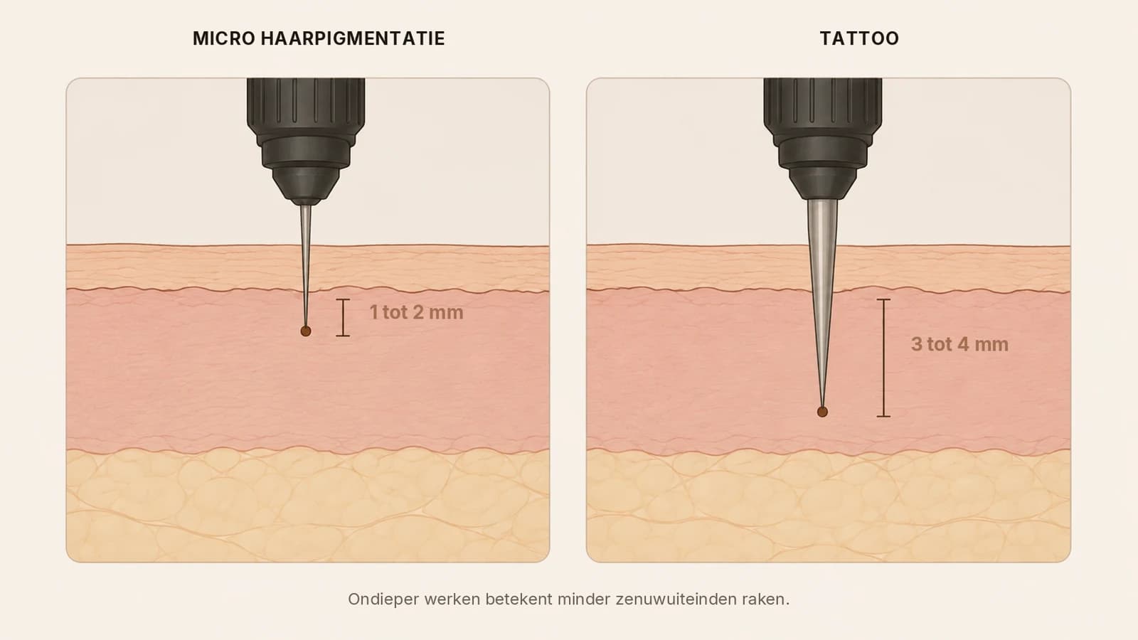 Doorsnede van de huid die de naalddiepte van micro haarpigmentatie vergelijkt met die van een tattoo