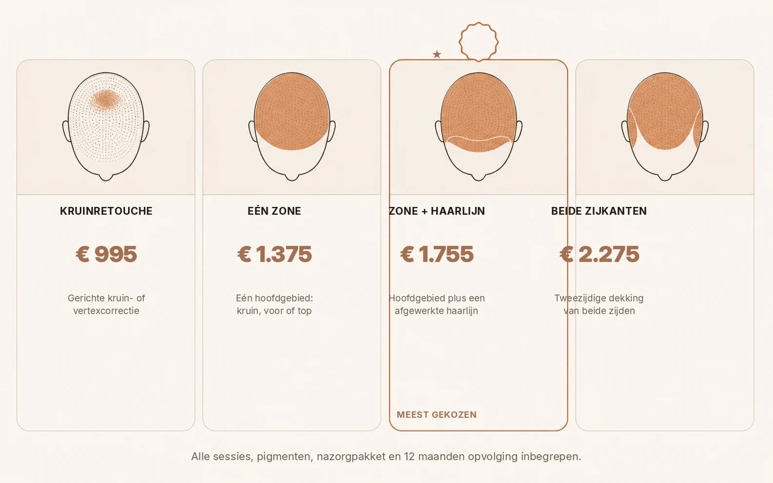 De vier pakketten micro haarpigmentatie met behandelzones en prijzen