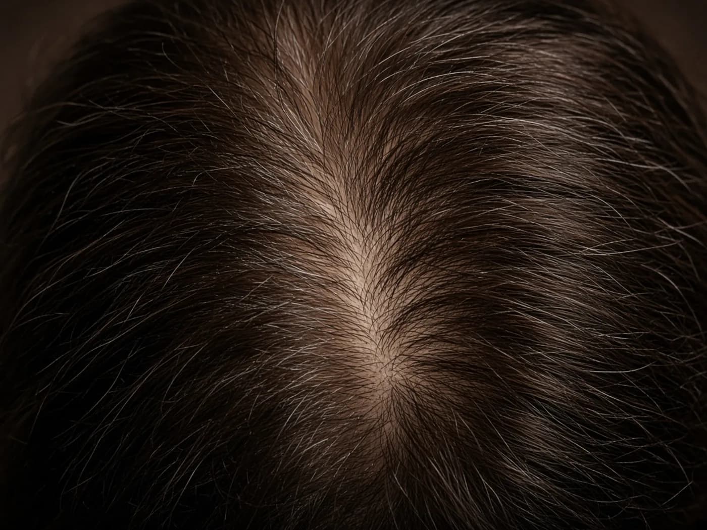 Top-down close-up of dark hair with a widening centre part — an overview of the different types of hair loss