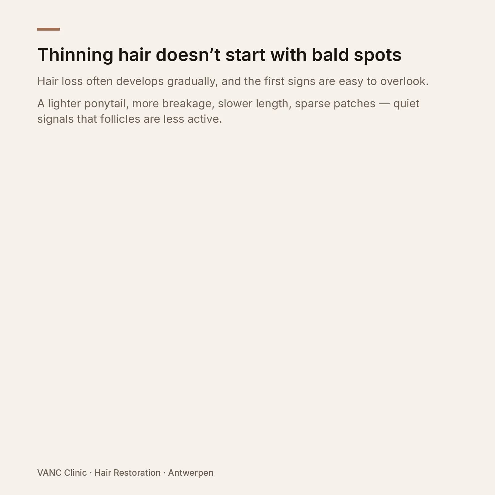VANC Clinic note — thinning hair often starts before visible bald spots